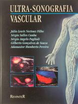Ultra sonografia vascular - REVINTER RJ