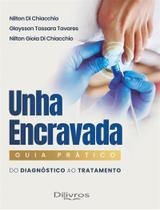 Unha Encravada Guia Pratico: Do Diagnóstico Ao Tratamento Unha Encravada Guia Pratico: Do Diagnóstico Ao Tratamento