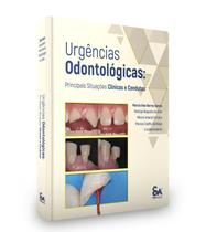 Urgências odontológicas: principais situações clínicas e condutas - Santos Publicações
