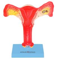 Útero com Trompas em Tamanho Natural, Anatomia