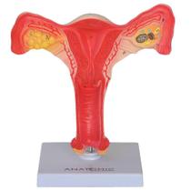 Útero Com Trompas Em Tamanho Natural, Anatomia