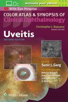 Uveitis, Autor: Sunir J. Garg