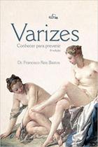 Varizes - conhecer para prevenir