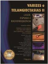 Varizes e Telangiectasias Ii - Laser, Espuma e Radiofrequencia