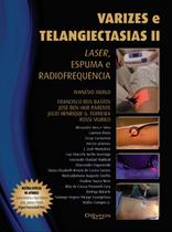Varizes e telangiectasias ii laser espuma e radiofrequencia Varizes e telangiectasias ii laser espuma e radiofrequencia