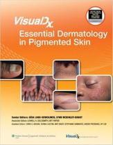 Visualdx - Essential Dermatology In Pigmented Skin - Lippincott Williams & Wilkins