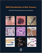 Who classification of skin tumours - World Health Organization