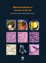 Who classification of tumours of the eye - WORLD HEALTH ORGANIZATION Who classification of tumours of the eye - WORLD HEALTH ORGANIZATION