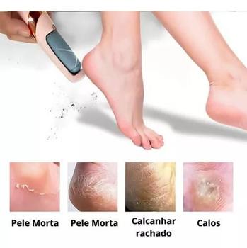 Imagem de Aparelho Lixa Elétrica Removedor de Calos 110V/220V: Inovação em Pedicure