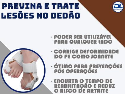 Imagem de 1 Par Corretor Protetor Ortopédico Articulado Para Joanete