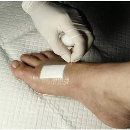 Imagem de 10 Curativo Para Colocar No Machucado Ferida C/ Compressa 8x15