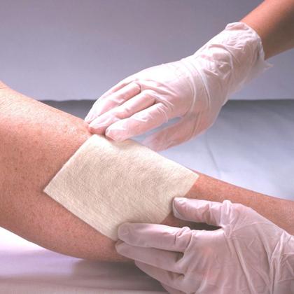 Imagem de 2 Curativos De Fibras Alginato Calcio P/ Feridas Vitamedical