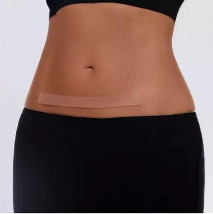 Imagem de 2 Fitas Silicone Para Cicatrizes e Queloide 70x3cm - Kelogel