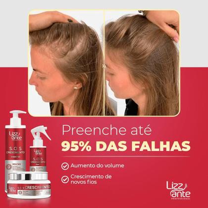 Imagem de 2 Kit SOS Crescimento Capilar Acelerado Combate Queda de Cabelo Calvicie Alopecia