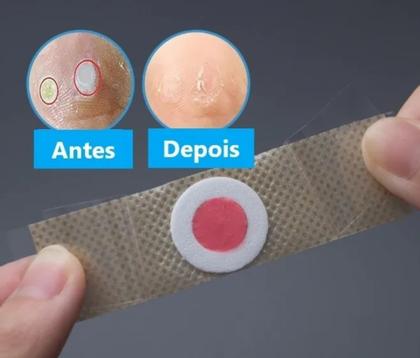 Imagem de 24 Adesivos Calos e Verrugas