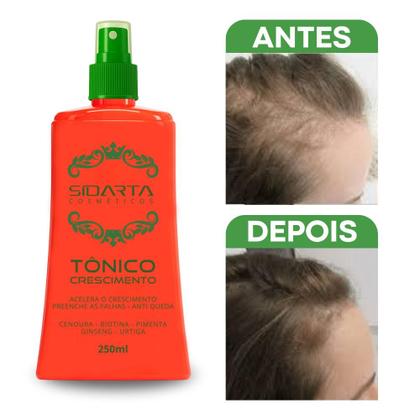 Imagem de 3 TÔNICOS F CAPILAR SIDARTA 250ml  Crescimento Acelerado