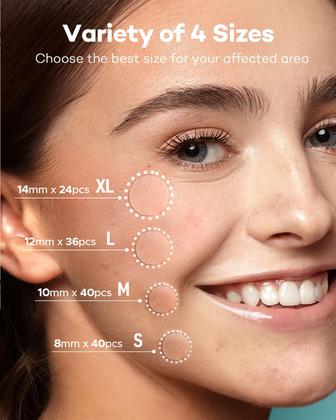 Imagem de Adesivo para acne TKTK TK-AC01, 140 adesivos, 4 tamanhos, óleo de melaleuca