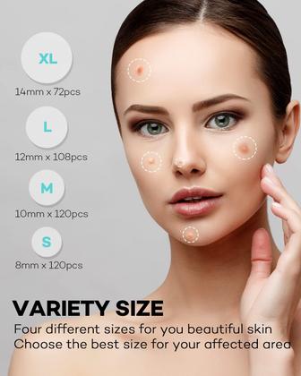 Imagem de Adesivo para acne TKTK TK-AC01, 420 adesivos, 4 tamanhos, óleo de melaleuca
