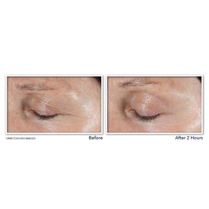 Imagem de Adesivos Anti-rugas RoC Retinol Correxion Deep Wrinkle (6 Unidades)