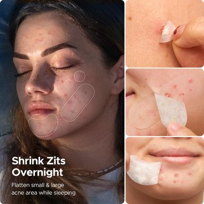 Imagem de Adesivos para acne e espinhas LitBear 600, hidrocolóide diurno/noturno, 5 tamanhos