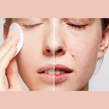 Imagem de Água Micelar Actine Darrow Pele Oleosa 100ml