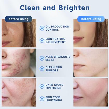 Imagem de Almofadas esfoliantes Ácido glicólico Ragkun com ácido salicílico 70 pastilhas