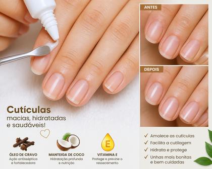 Imagem de Amolecedor De Cutículas, Óleo De Cravo+Manteiga De Coco e Vitamina E, Ouribel 100ml