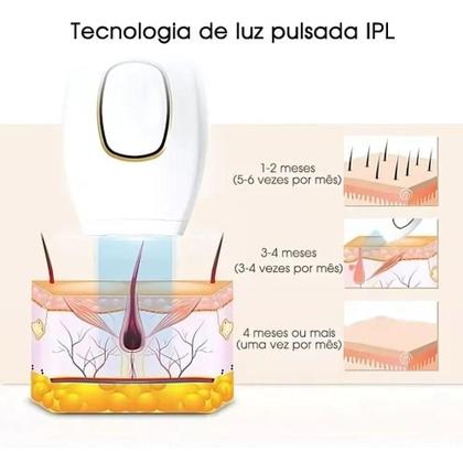 Imagem de Aparelho de Depilação a Laser com Aplicação Rápida e Confortável