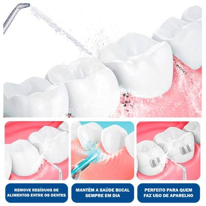 Imagem de Aparelho Dental Elétrico Bivolt Para Limpeza Completa De Dentes Gengiva E Prótese