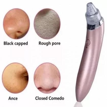 Imagem de Aparelho Dermoabrasão Sucção Tira E Remove Cravos E Espinhas