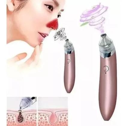 Imagem de Aparelho Dermoabrasão Sucção Tira E Remove Cravos E Espinhas