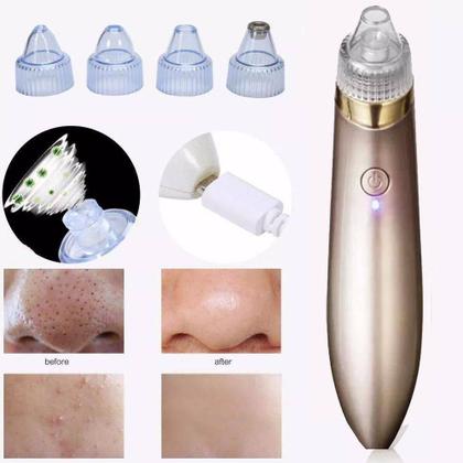 Imagem de Aparelho Extrator Removedor Espinhas Cravos