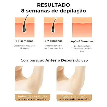 Imagem de Aparelho IPL com Tecnologia Avançada com Aplicação Rápida e Confortável