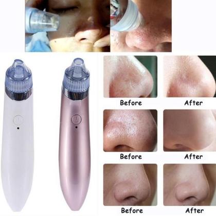 Imagem de Aparelho Removedor Extrator Cravos Espinhas Sucção A Vácuo