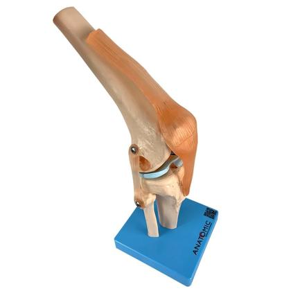 Imagem de Articulação Do Joelho Com Ligamentos Esqueleto