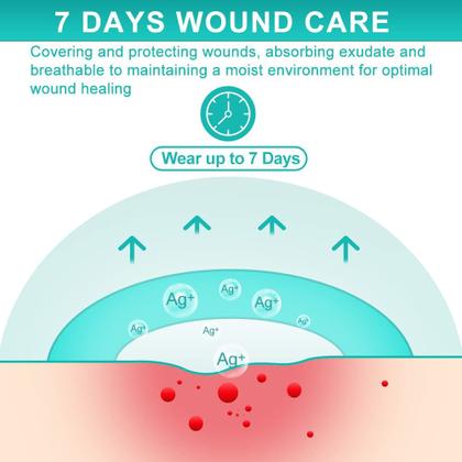 Imagem de Bandagens para tratamento de feridas Dimora Ag Silver Sacrum Foam 7x7cm