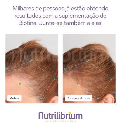 Imagem de Biotina Pura Beauty Cabelo Pele e Unhas 60 Capsulas Nutrilibrium