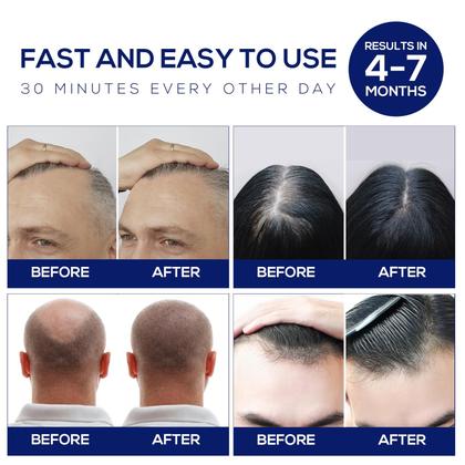 Imagem de Boné de crescimento de cabelo a laser NNUSHK Red Light Therapy Black