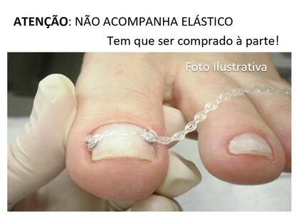 Imagem de Botão Botton Cerâmico C/10 unidades p/ Órtese Podologia
