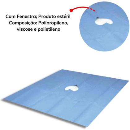 Imagem de Campo Cirúrgico Estéril Fenestrado PolarFiX