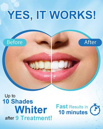 Imagem de Caneta clareadora de dentes MySmile Non-Sensitive 8mL 30+ Tratamentos