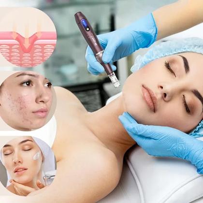 Imagem de Caneta Derma Sem Fio Micro Microagulhas Máquina De Rejuvenescimento Da Pele Dr.pen Ultima A10 Com