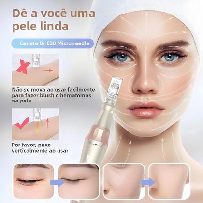 Imagem de Caneta Micro Skin Sem Fio Com 12 Cartuchos De Reposição Para Sistema De Microagulhamento, Cuidados