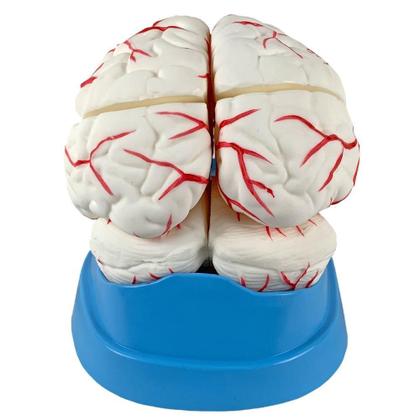 Imagem de Cérebro Com Artérias Em 8 Partes