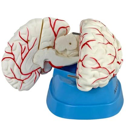 Imagem de Cérebro Com Artérias Em 8 Partes