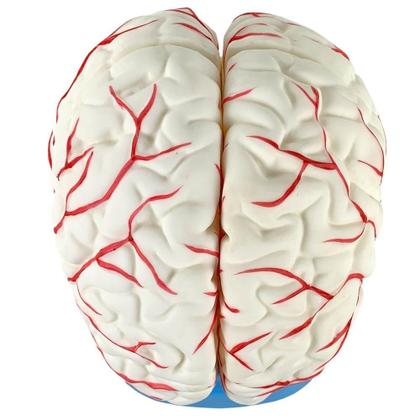 Imagem de Cérebro Com Artérias Em 8 Partes