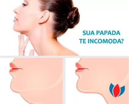 Imagem de Cinta Faixa Facial Pós Cirurgia Papada Bichectomia