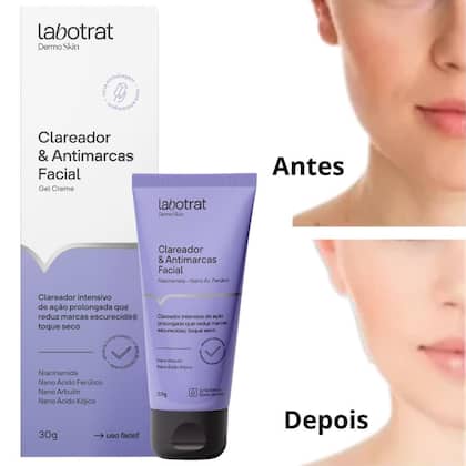 Imagem de Clareador Antimarcas Facial Gel Creme Dermo Skin Labotrat 30g