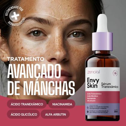 Imagem de Clareador Facial Zencial Potente Para Acne, Melasma e Manchas Resistentes com Ativos Profundos 30ml