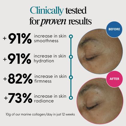 Imagem de Colágeno em pó ENSANTÉ Premium Marine Tipo I II III IV com vitamina C